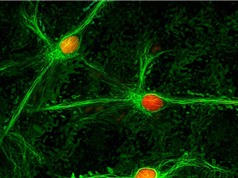 Phát hiện vùng não liên quan đến các cơn đau mãn tính