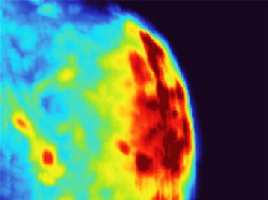 Nhiệt kế dựa trên ánh sáng và âm thanh giúp các hạt nano vàng tiêu diệt ung thư