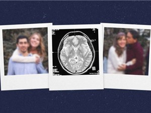 Vì sao những người mắc Alzheimer quên mất người thân?