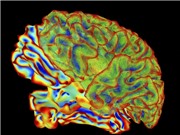 AI giải mã hoạt động của não bộ thành văn bản