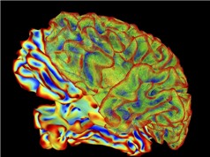 AI giải mã hoạt động của não bộ thành văn bản