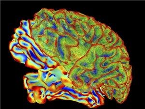 AI giải mã hoạt động của não bộ thành văn bản