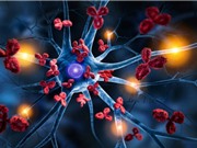 Hệ thống hình ảnh nhỏ gọn có khả năng phân biệt chính xác mô ung thư