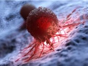 Vì sao một số dạng ung thư biểu mô lại kháng điều trị mạnh?